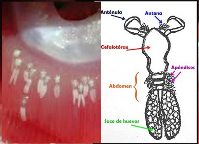 Ergasilus en peces 2