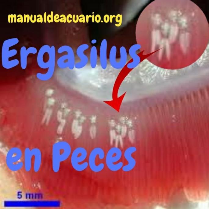 Ergasilus en peces