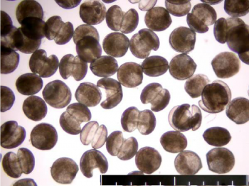 Larvas de mejillones o glochidium